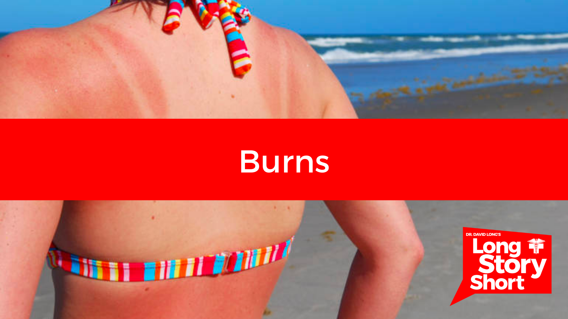 Read more about the article Burns – Dr. David Long
