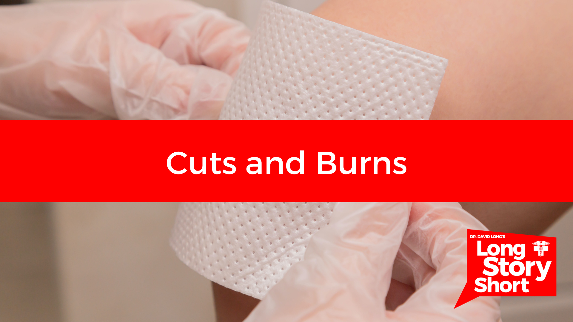 You are currently viewing Cuts and Burns – Dr. David Long