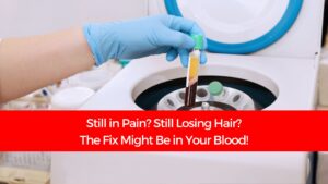 Read more about the article Still in Pain? Still Losing Hair? The Fix Might Be in Your Blood!