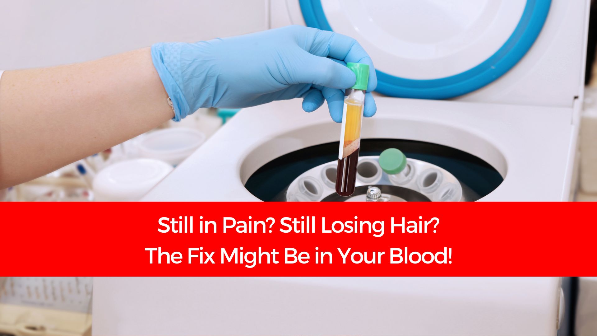 You are currently viewing Still in Pain? Still Losing Hair? The Fix Might Be in Your Blood!